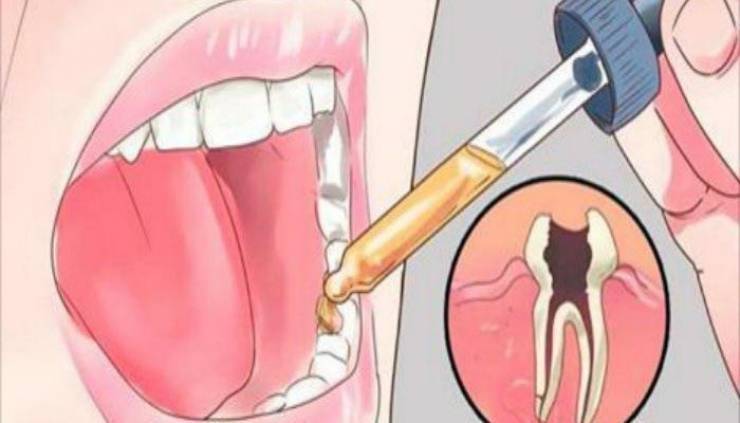 ضعوا هذا الخليط على السنّ.. وسيختفي الألم كالسحر