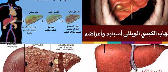 بالفيديو: في 3 أيام فقط .. تنظيف الرئتين والقولون من الدهون والسموم!