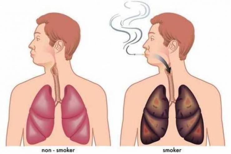 أفضل مشروب طبيعي يطهّر الرئتين من آثار التدخين!