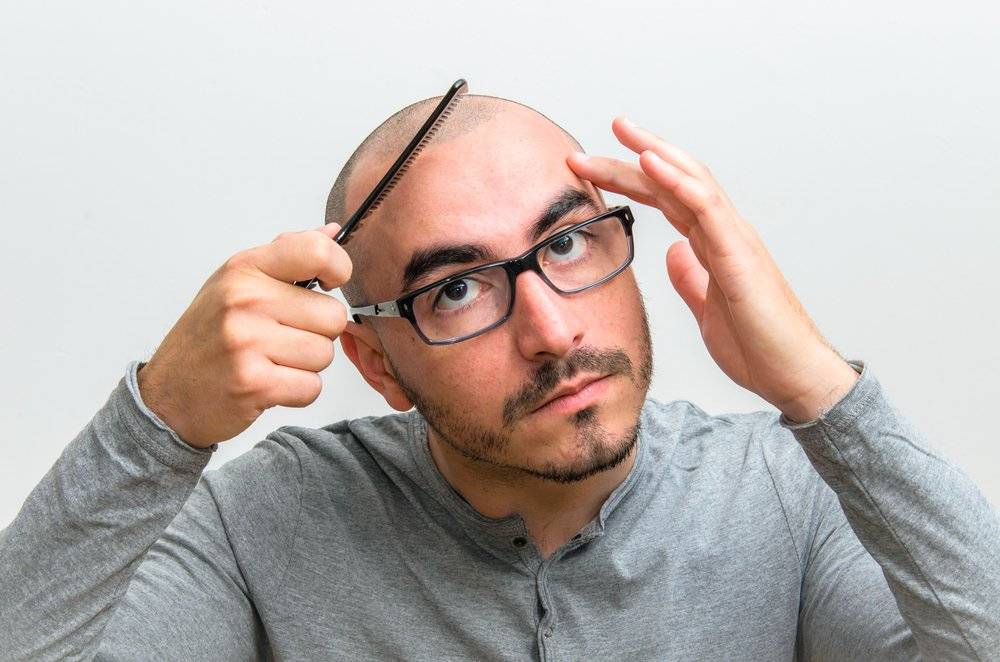 عزيزي الأصلع لا تيأس...وإليك السبب