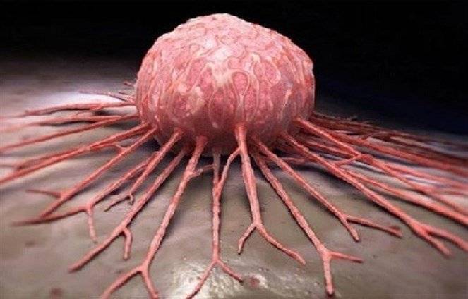 الخبراء يكشفون 8 طرق سهلة تقي من الإصابة بالسرطان