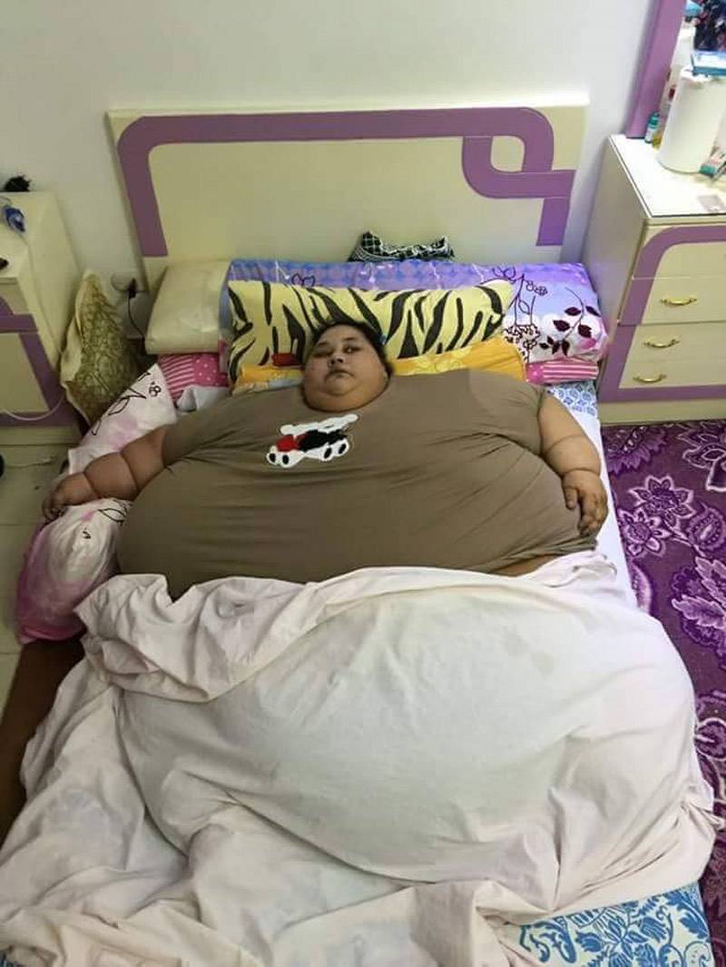 بالصور شاهد.. مصرية وزنها نصف طن ولم تخرج من منزلها منذ ربع قرن