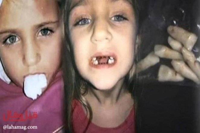 بالفيديو : شكّت بطبيب الأسنان.. فصوّرت لتكتشف ماذا يفعل بابنتها !