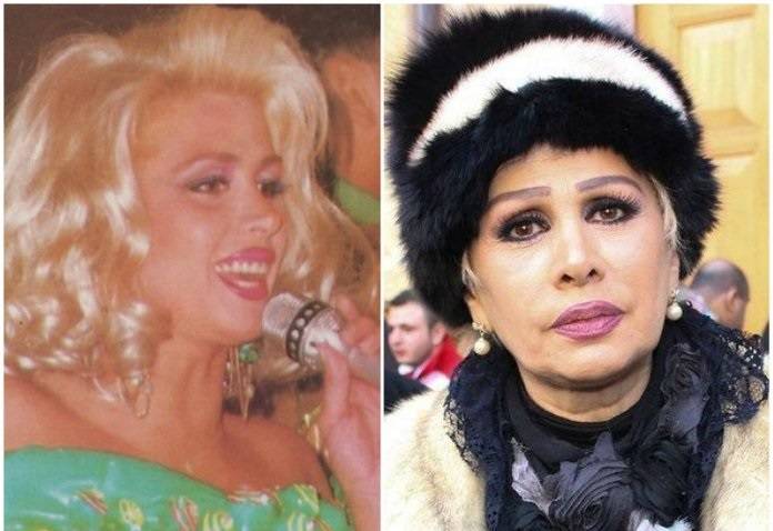 صور تغيرات صادمة لأشهر نجمات الاستعراض: الصورة الأخيرة ستفاجئكم!