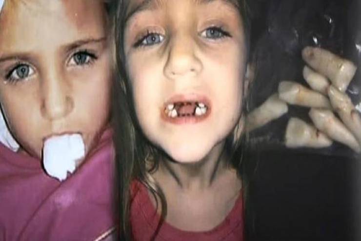 فيديو: صوّرت ابنتها خفية عند طبيب الأسنان.. وما فعله بالصغيرة كارثة!