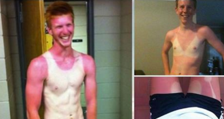شاهدوا.. أشخاص نسوا أن الشمس تترك آثاراً على الجسم فكانت الكارثة!
