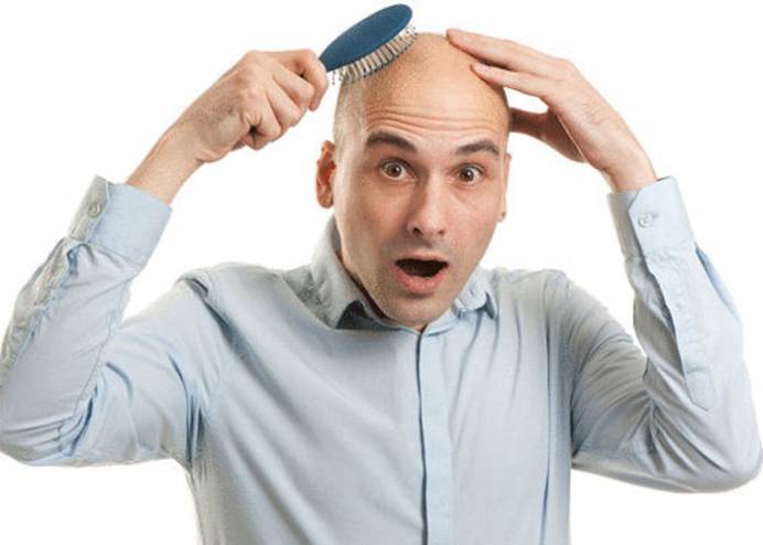 أسباب تساقط شعر الرجال!