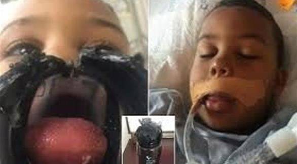 علّق لسانه بقارورة مياه.. فأُدخل العناية المركزة!