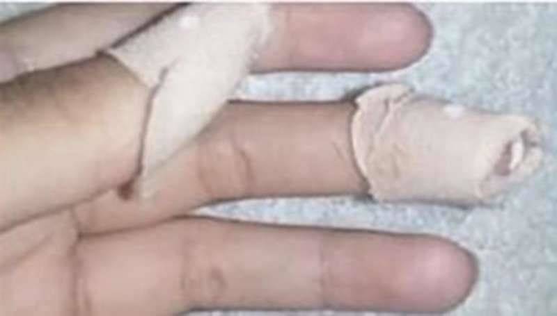 معلمة تعنّف طالبة باقتلاع أظافرها في المدرسة!