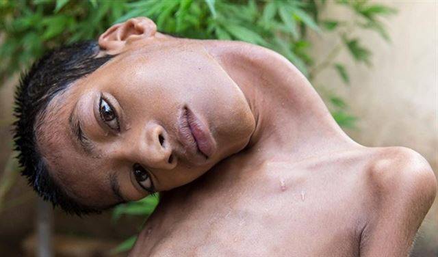 بعد محاولة إنقاذ حياته.. تناول غداءه أمام شاشة التلفزيون ومات بهدوء