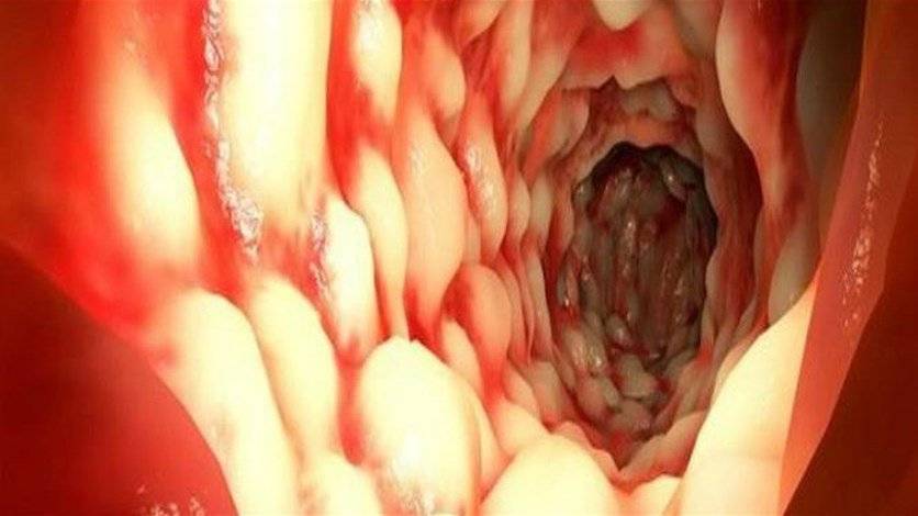 تناولوا هذه السلطة لمدة 3 أيام... النتيجة ستذهلكم!