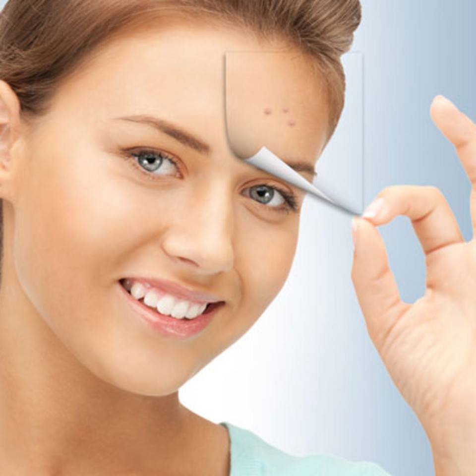 طرق مذهلة لعلاج حب الشباب!