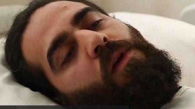 شهادات مروعة عن حالات تعذيب في تركيا بعد محاولة الانقلاب