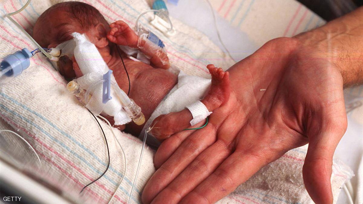 إليزابيث "معجزة بشرية" وزنها 500 غرام