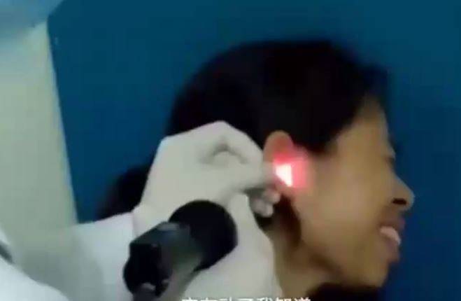 ما أخرجه الأطباء من أذن امرأة مرعب!!