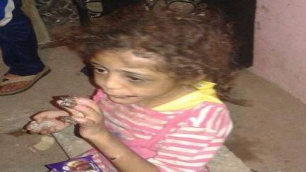 بالصور: عذّب طفلته جلدًا وحرقًا.. والسبب صادم