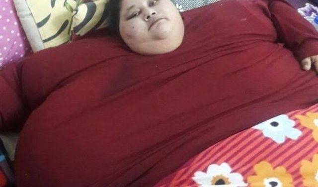 جراحة لإنقاص وزن مصرية تزن 500 كيلوغرام