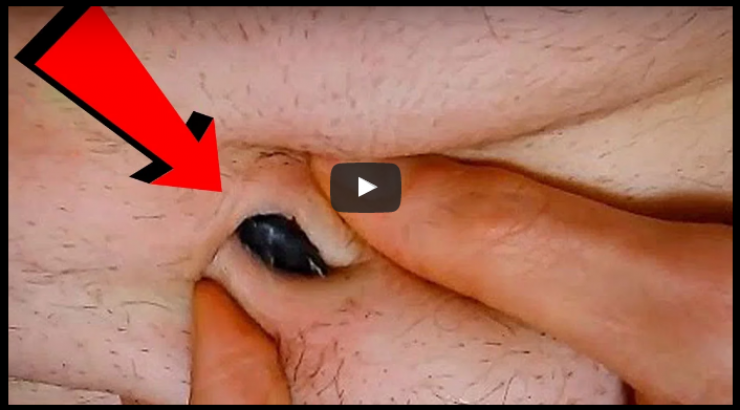 بالفيديو: هذه أقذر 10 مناطق في جسم الانسان