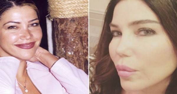 بالصور: فنانات قبل وبعد التجميل.. لن تصدّقوا الفرق