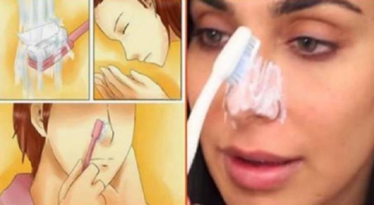 تخلصوا من الرؤوس السوداء بطريقة سهلة ومضمونة!
