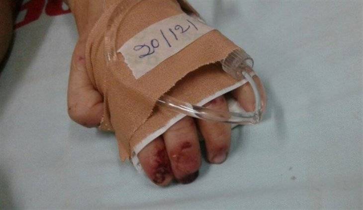 بالصور - جريمة مروعة بطلها شاب لبناني: حرق جسد طفله بالسجائر واقدم على.... المفاجأة أنه.. !؟