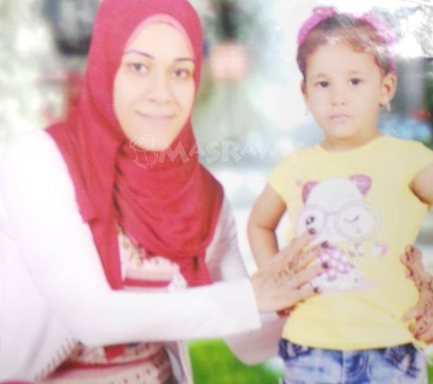 بالصور.. دافعت عن شرفها فحرقها شقيق زوجها بـ”الزيت المغلي”