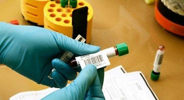 الإعلان عن أول حالة شفاء من «الإيدز»