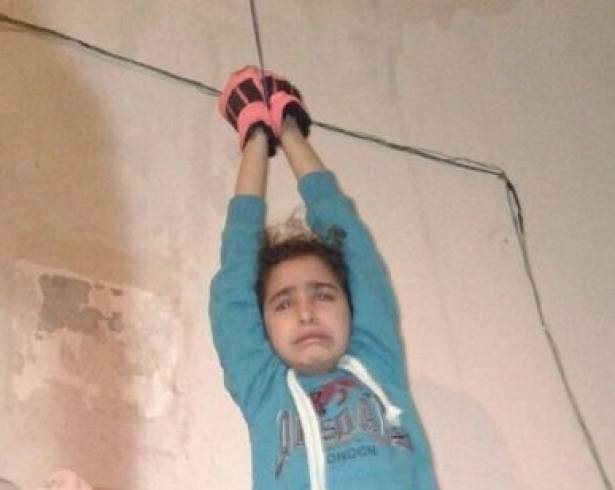 في لبنان.. أب يعذب طفلته بوحشية لإجبارها على التسول!