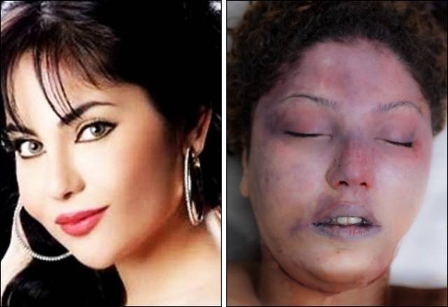 هل تذكرون الفنّانة السورية التي ذبحها شقيقها؟ كشف تفاصيل جديدة وصور الجريمة!