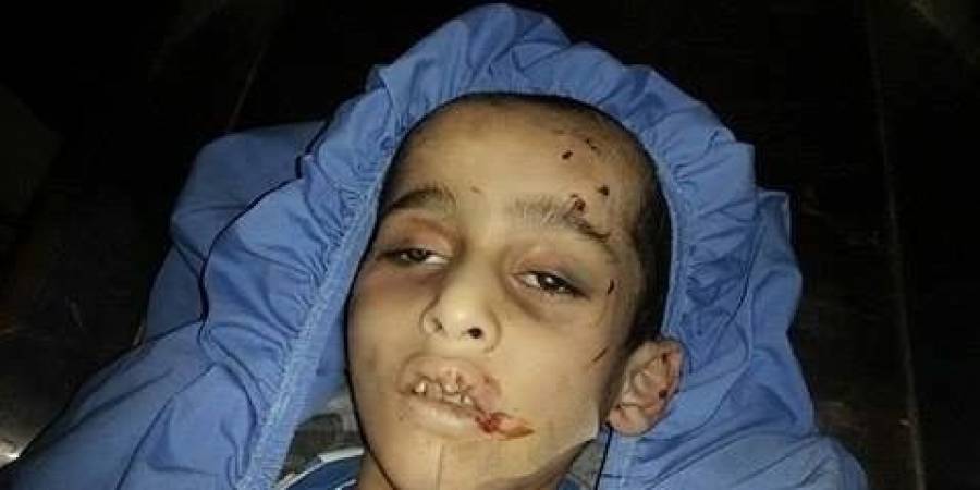 وفاة طفل نتيجة التعذيب على يد زوجة ابيه قرب قلقيلية والأمن يقبض عليها