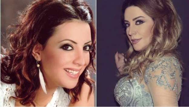 17 نجمة لبنانية ومصرية وخليجية ضمن قائمة الأكثر توفيقاً في العمليات التجميلية عبر التاريخ!