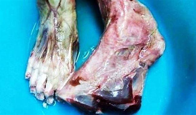 صدمة.. قدم بشرية مقطوعة في مطعم صيني