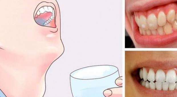 خدع قوية للتخلص من إصفرار الأسنان ورائحة الفم الكريهة.. لا تفوتيها!