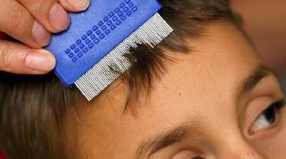 العلاجات الكيميائية للقمل تهدد الحامل