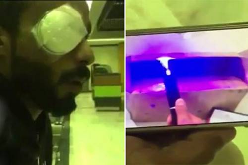 فقد عينه بسبب أمر يقوم به كثيرون.. فاحذروا!
