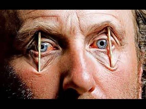 هذا ما حلّ بشاب بقي مستيقظاً لمدة 11 يوماً