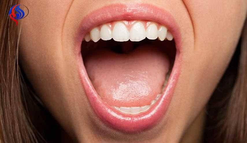 هل حرقت لسانك؟ عشرة حلول طبيعية للتخلص من الوجع بسرعة