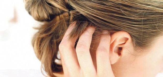اليكم 8 أسباب مفاجأة وراء الحكة الجلدية!