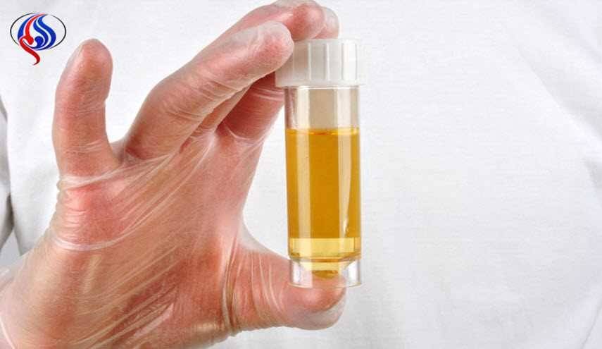 رائحة البول الكريهة تخبرك بمشكلات صحية وهي ...