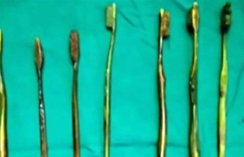 فتاة تبتلع 7 فراشي أسنان بعد محاولة إجبارها على الزواج