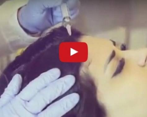 بالفيديو - نجمة أراب آيدول تخضع لعلاج الشعر! من هي؟!