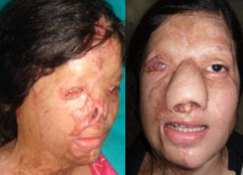 لن تصدق كيف أصبح وجه هذه المرأة بعد سنوات من العمليات؟