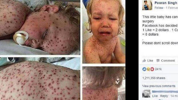 قصّة "طفل السرطان" تجتاح الإنترنت و"فيسبوك" يتدخّل.. لن تتخيلوا الحقيقة!