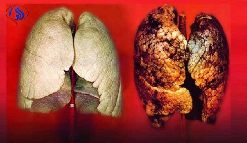 بشرى سارة.. خضار ينظف الرئتين من التدخين بأسرع وقت
