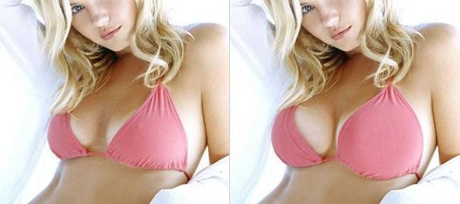 ما هي عملية التجميل الأكثر رواجاً في 2017؟