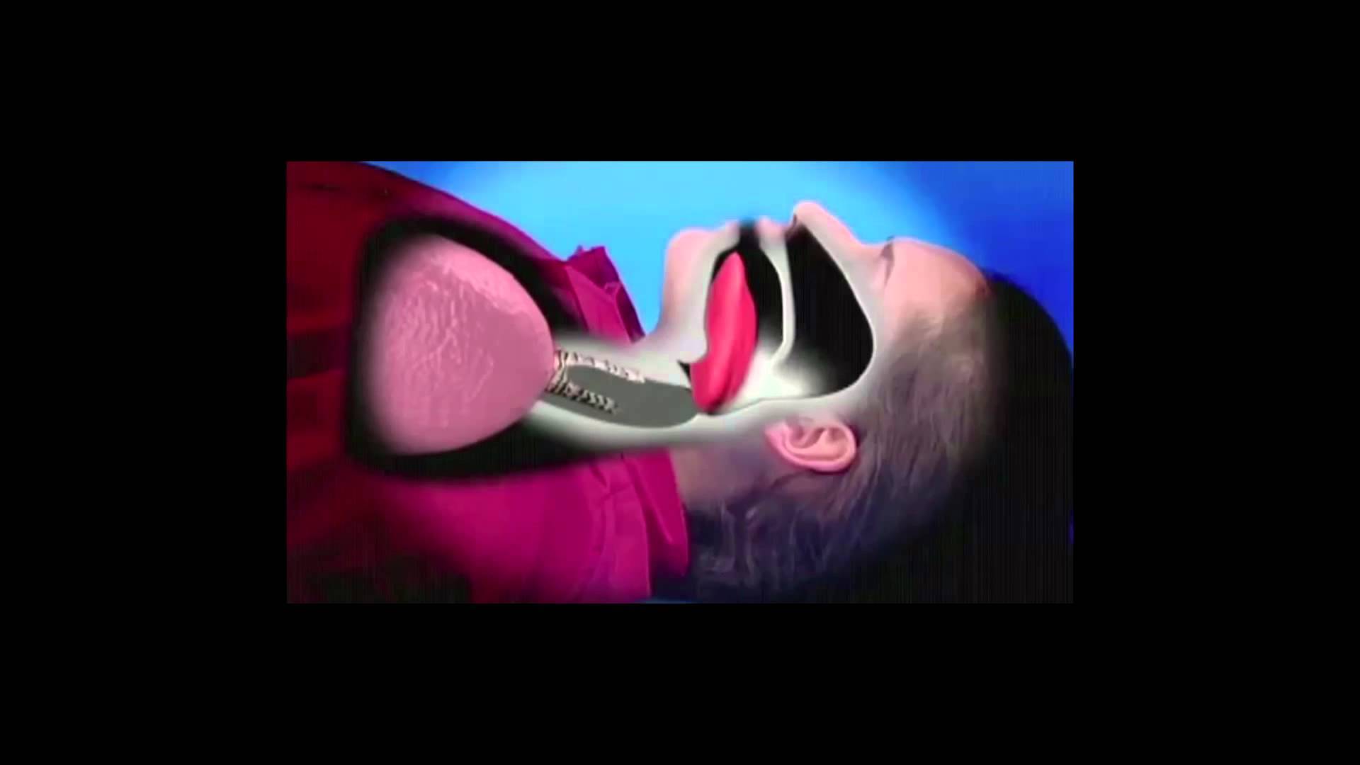 كيف تنقذ شخصاً من الموت في حال 