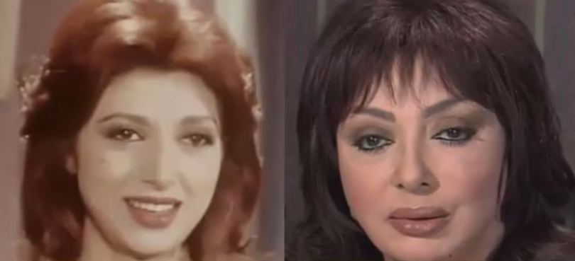 نجوم عرب وقعوا ضحايا عمليات التجميل الفاشلة وبعضهم خسر حياته!!