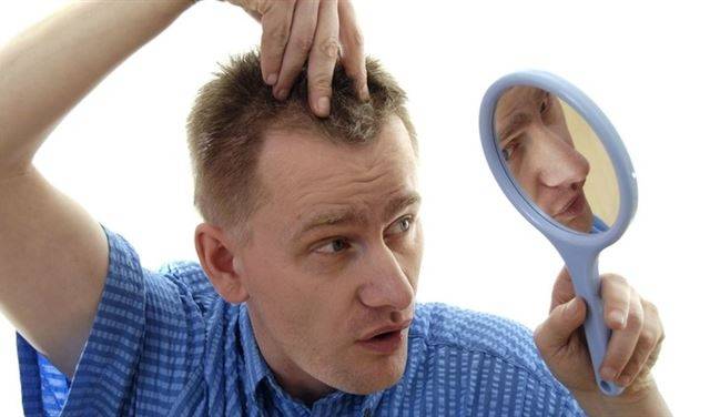 صفات الرجال المعرضين للصلع المبكر