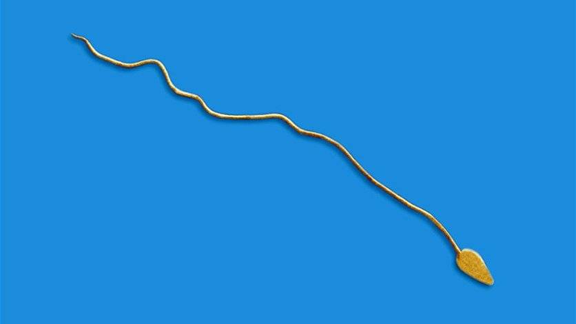 خصوبة الرجال في أدنى مستوياتها... ما السبب وكيف يمكن تجنّب ذلك؟
