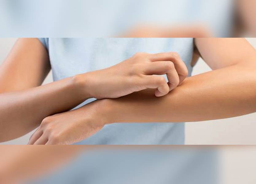 هل تحك جلدك عند مشاهدتك لشخص آخر يقوم بذلك؟